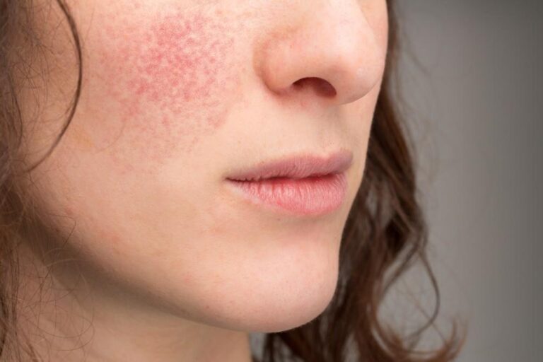 10 Nourishing Skincare Tips for Soothing Sensitive Skin