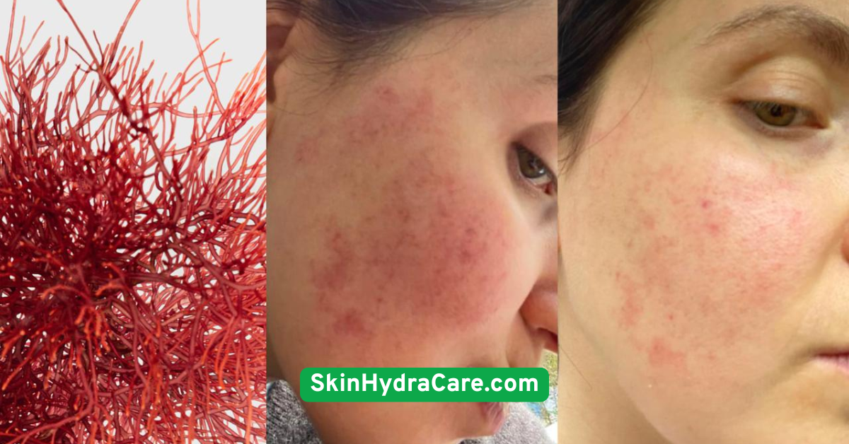 See a Dermatologist if Redness Persists