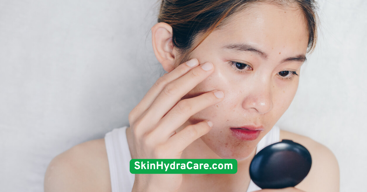 Avoid Touching or Picking Your Face