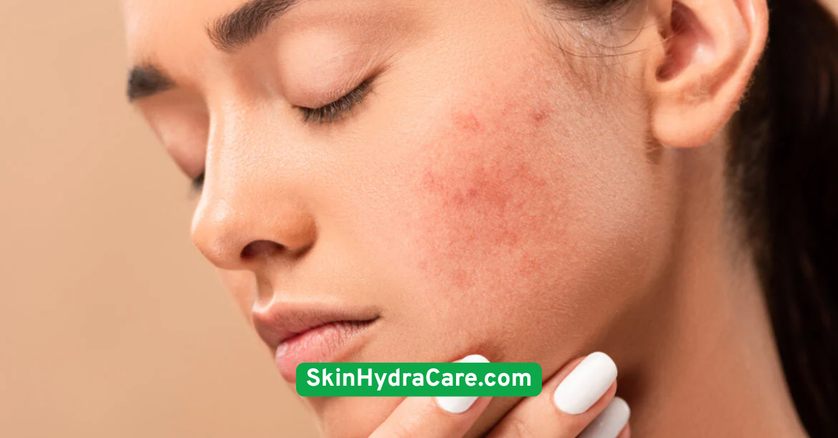 Choose Non-Comedogenic, Lightweight Products