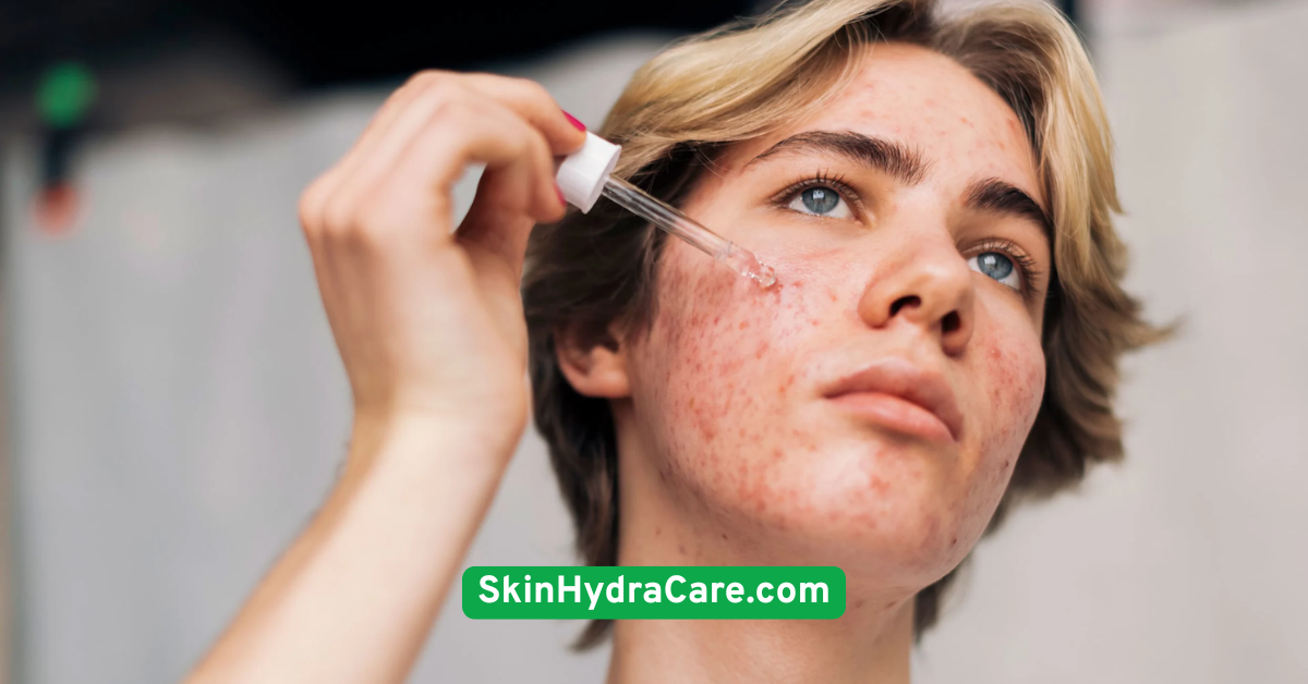 Avoid Touching Active Breakouts