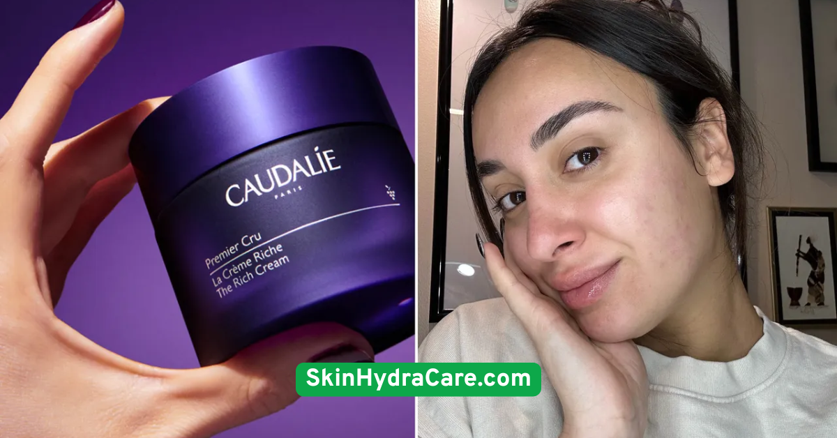 Use Richer Creams in Winter